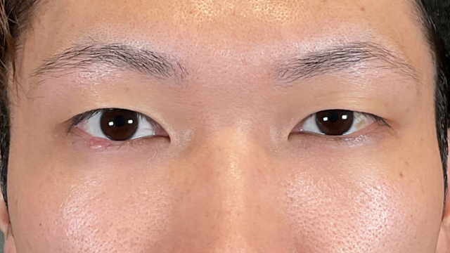 Postoperative Condition Part 1