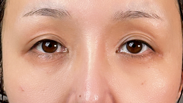 Postoperative Condition Part 1