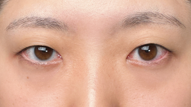 Postoperative Condition Part 1