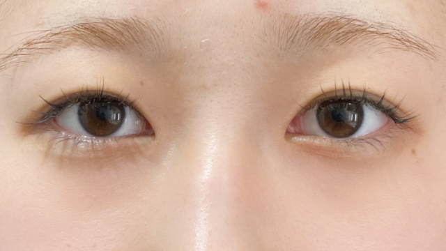 Postoperative Condition Part 1