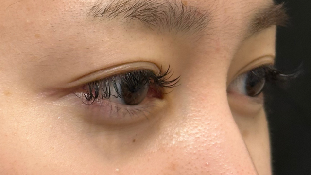 Postoperative Condition Part 1