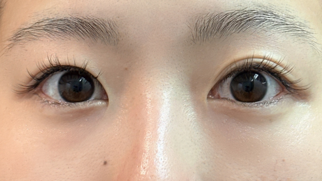 Postoperative Condition Part 1