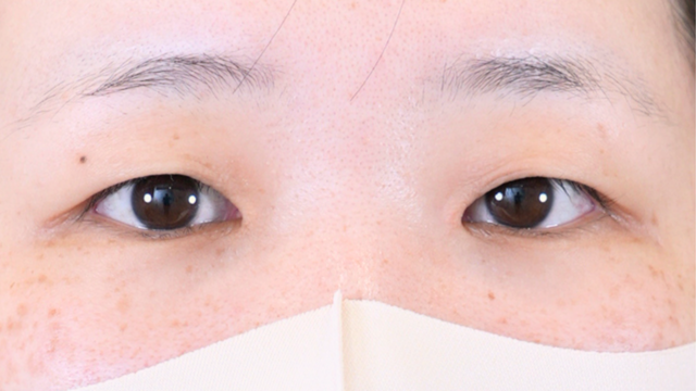 Postoperative Condition Part 1