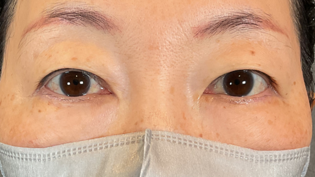 Postoperative Condition Part 1