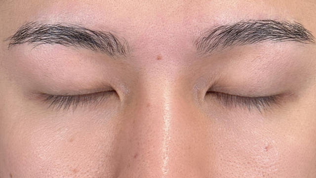 Postoperative Condition Part 1