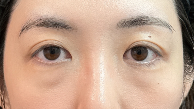 Postoperative Condition Part 1