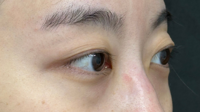 Postoperative Condition Part 1