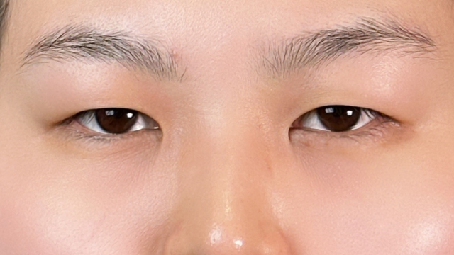 Postoperative Condition Part 1