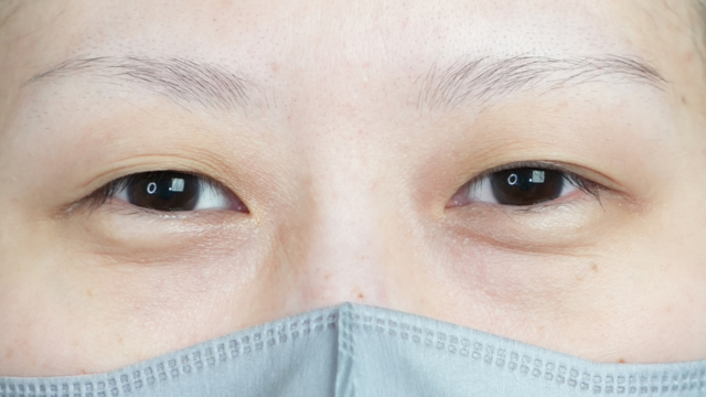 Postoperative Condition Part 1