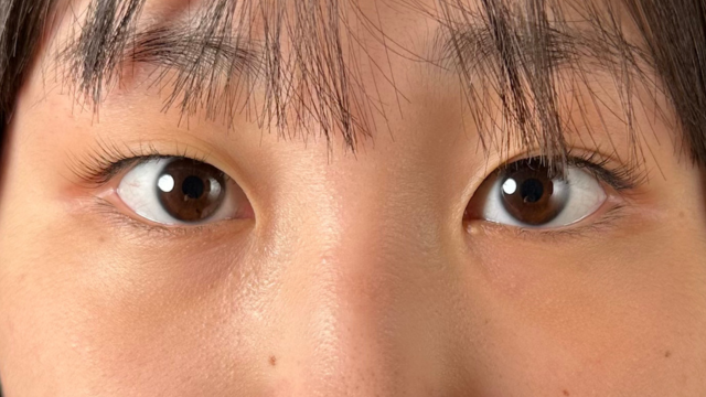 Postoperative Condition Part 1