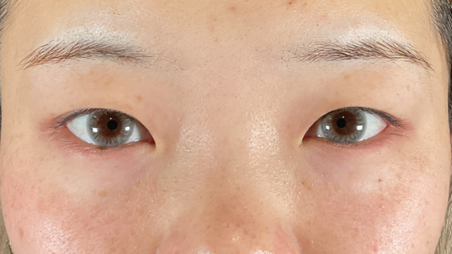 Postoperative Condition Part 1