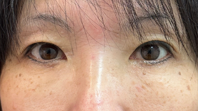 Postoperative Condition Part 1