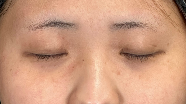 Postoperative Condition Part 1