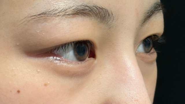 手术前的状态 其一