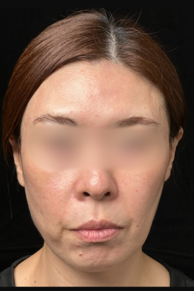 Postoperative Condition Part 1