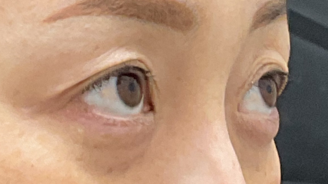 Postoperative Condition Part 1