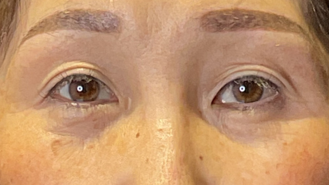 Postoperative Condition Part 1