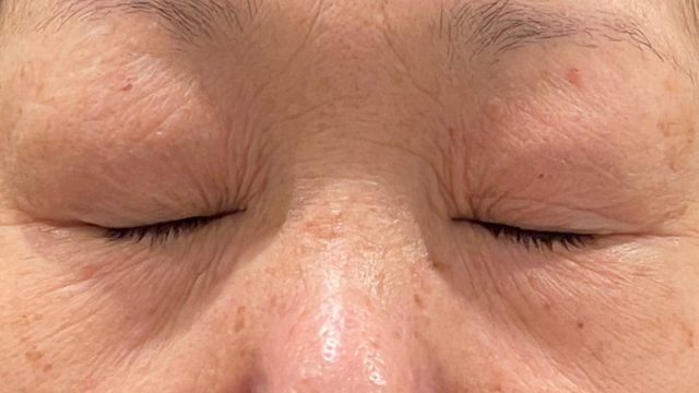 Postoperative Condition Part 1