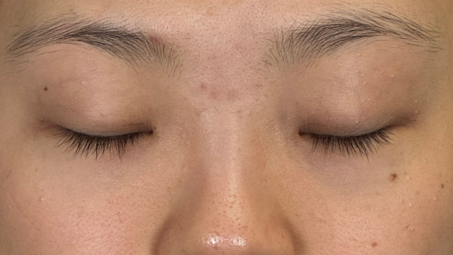 Postoperative Condition Part 1