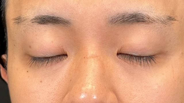 Postoperative Condition Part 1