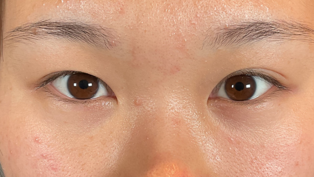 Postoperative Condition Part 1