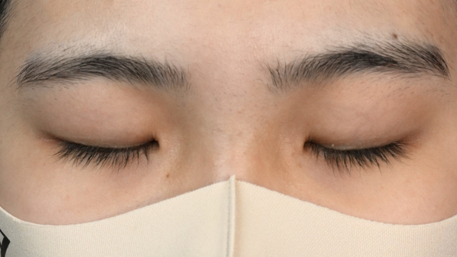 Postoperative Condition Part 1