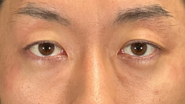 Postoperative Condition Part 1