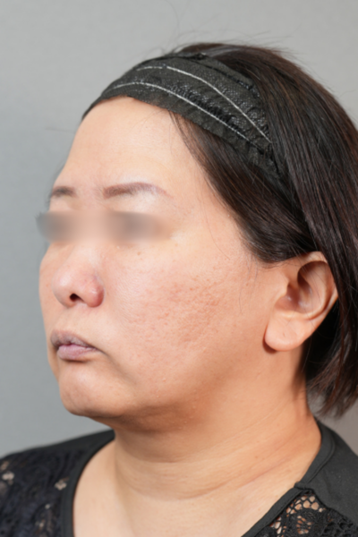 Postoperative Condition Part 1