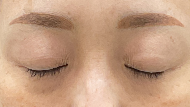 Postoperative Condition Part 1