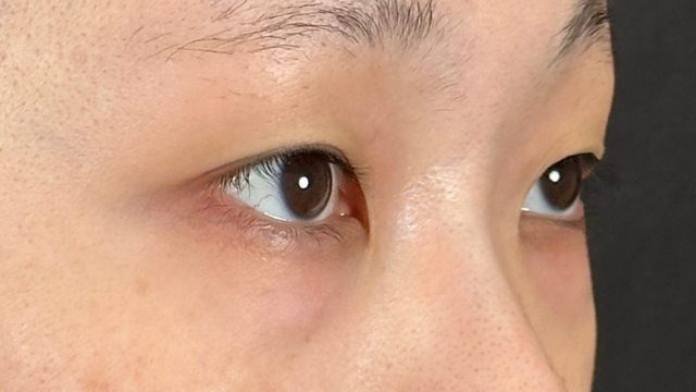 Postoperative Condition Part 1