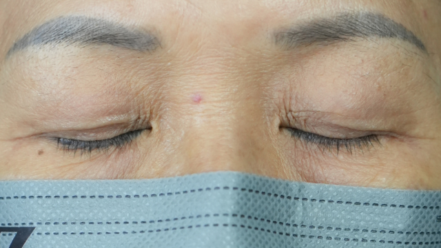 Postoperative Condition Part 1