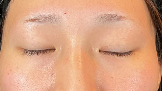 Postoperative Condition Part 1