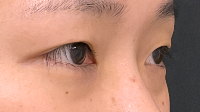 Postoperative Condition Part 1