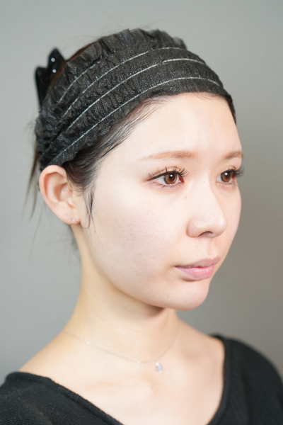 Postoperative Condition Part 1