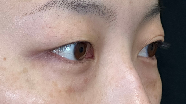 Postoperative Condition Part 1