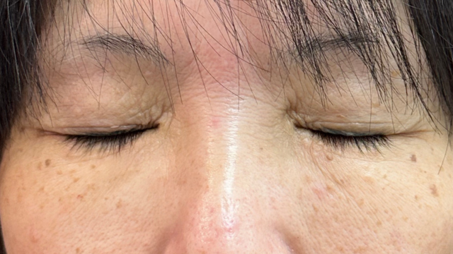 Postoperative Condition Part 1