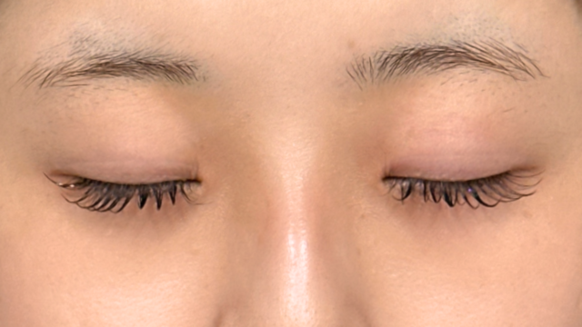 Postoperative Condition Part 1