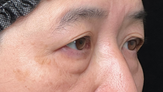 Postoperative Condition Part 1