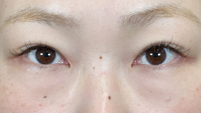 Postoperative Condition Part 1