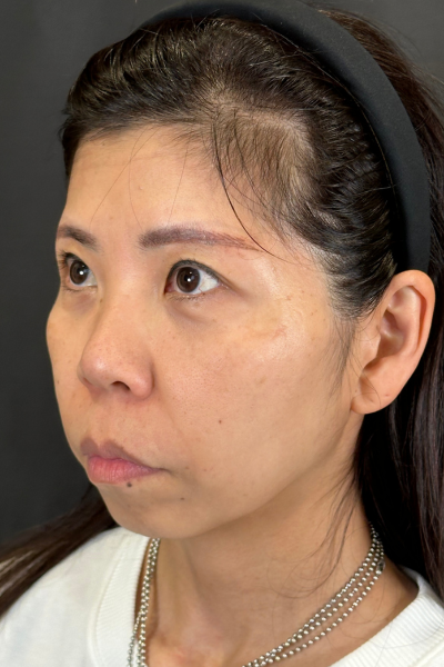 Postoperative Condition Part 1