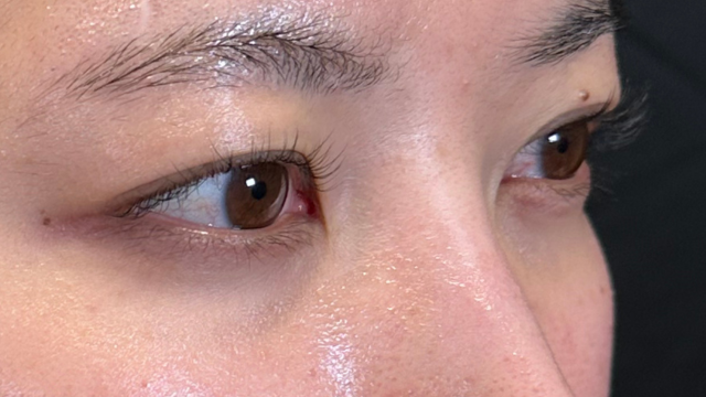 Postoperative Condition Part 1