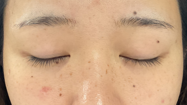 Postoperative Condition Part 1