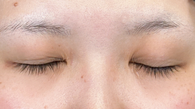 Postoperative Condition Part 1