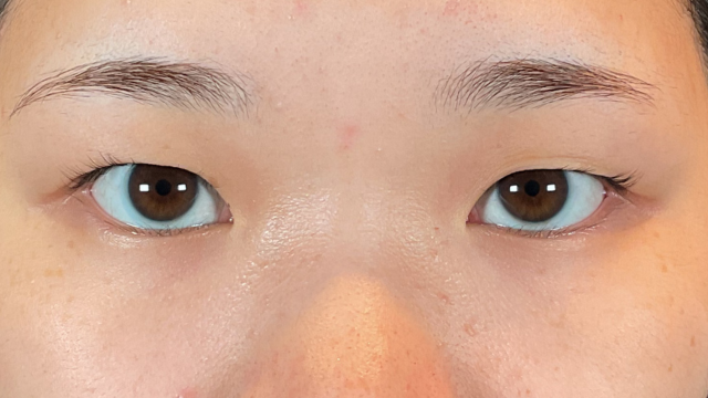 Postoperative Condition Part 1