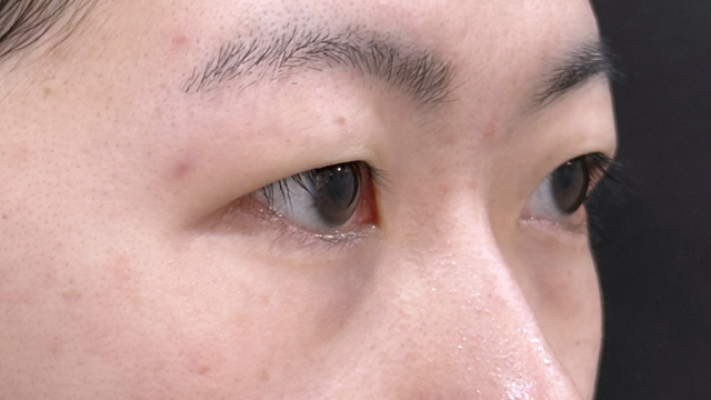 Postoperative Condition Part 1