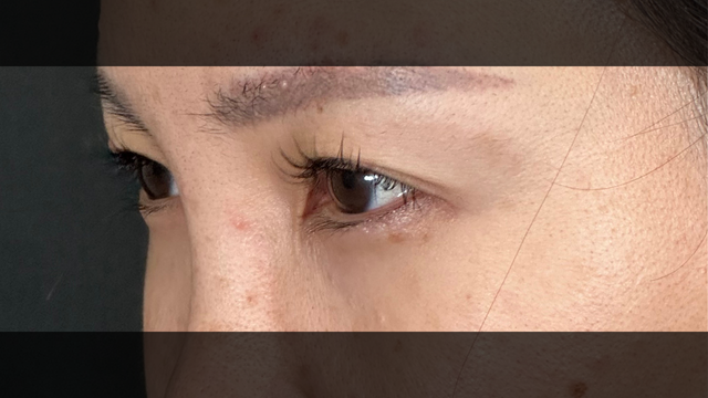 Postoperative Condition Part 1