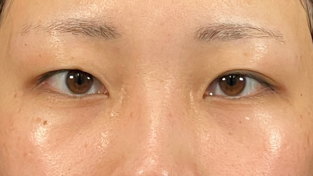 Postoperative Condition Part 1