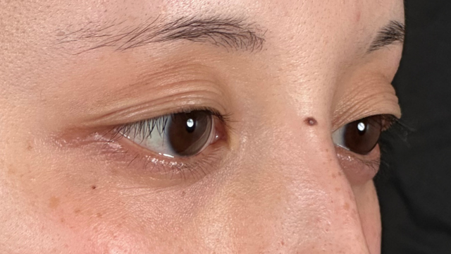 Postoperative Condition Part 1