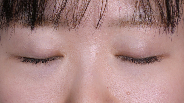 Postoperative Condition Part 1