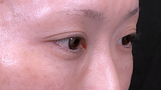 Postoperative Condition Part 1